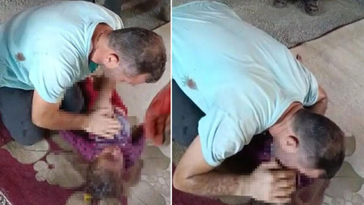 Çorum'da gecekondu yangını; 2 çocuğa ilk müdahale