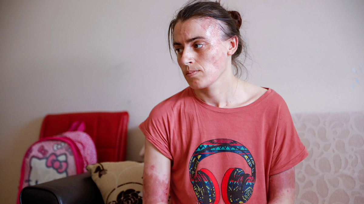 Eltisini 17 kez bıçaklayıp üzerine su döktü