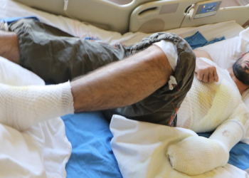 Epilepsi nöbeti geçirirken çorba kazanına düştü