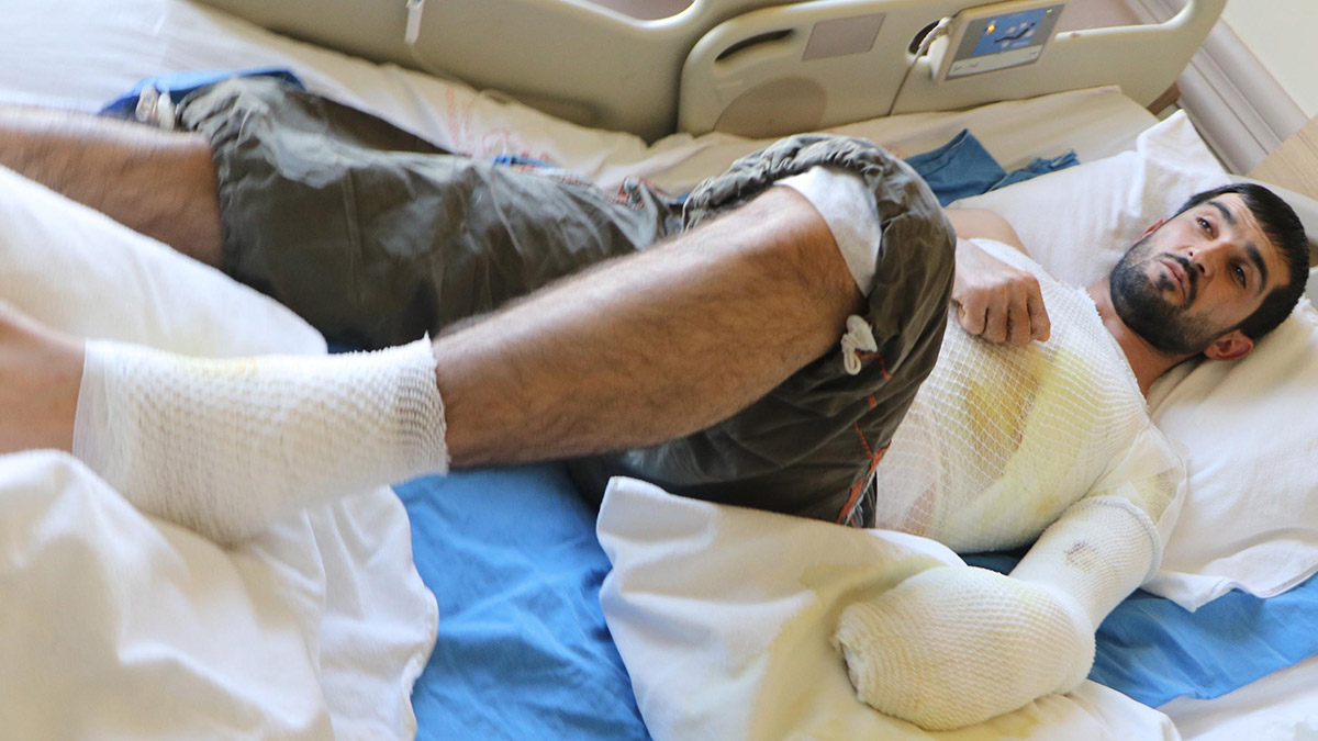 Epilepsi nöbeti geçirirken çorba kazanına düştü