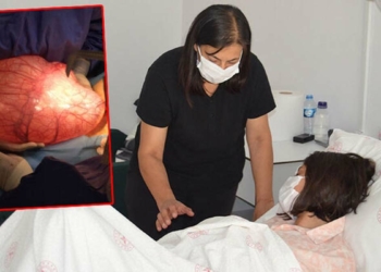 Genç kızın karından 7 kilo 800 gram kitle çıkartıldı