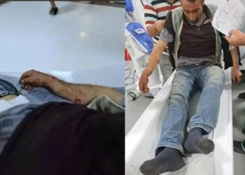 Yaylada ayı saldırısına uğrayan çoban yaralandı