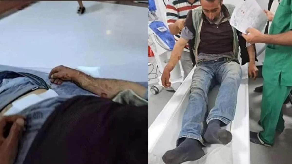 Yaylada ayı saldırısına uğrayan çoban yaralandı