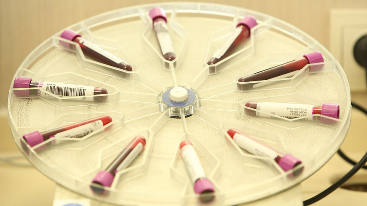 Her yıl eylül ayının üçüncü cumartesi günü gönüllü kemik iliği bağışçılarına teşekkür etmek amacıyla Dünya Kök Hücre Bağışçıları Günü olarak kutlanıyor.