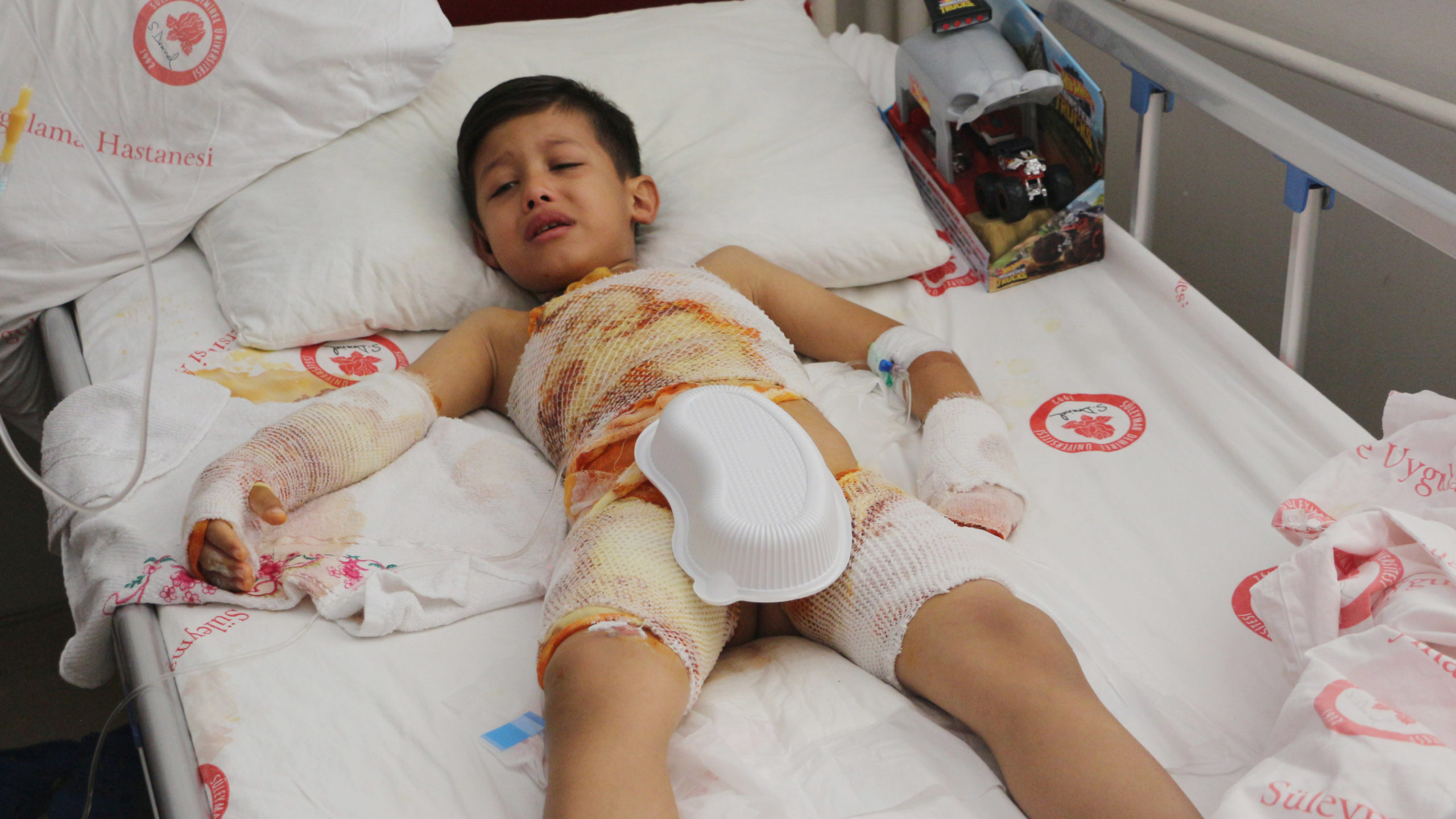 6 yaşındaki öğrencinin üzerine kaynar su döküldü