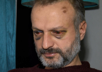 'Çiftetelli' için dövülen müzisyen: Çok mağdurum
