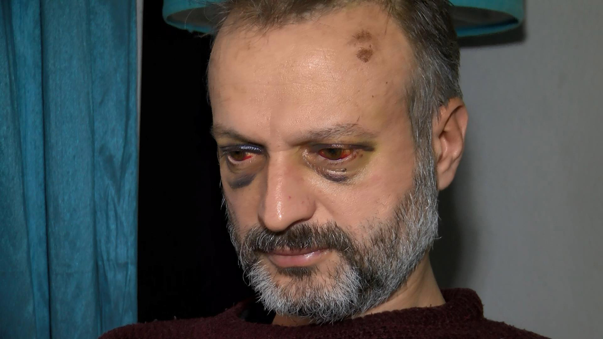 'Çiftetelli' için dövülen müzisyen: Çok mağdurum