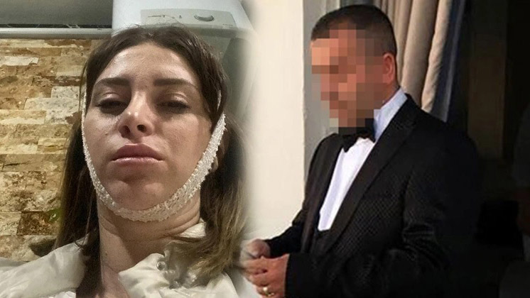 Eşini tabanca kabzasıyla darbetmişti, teslim oldu