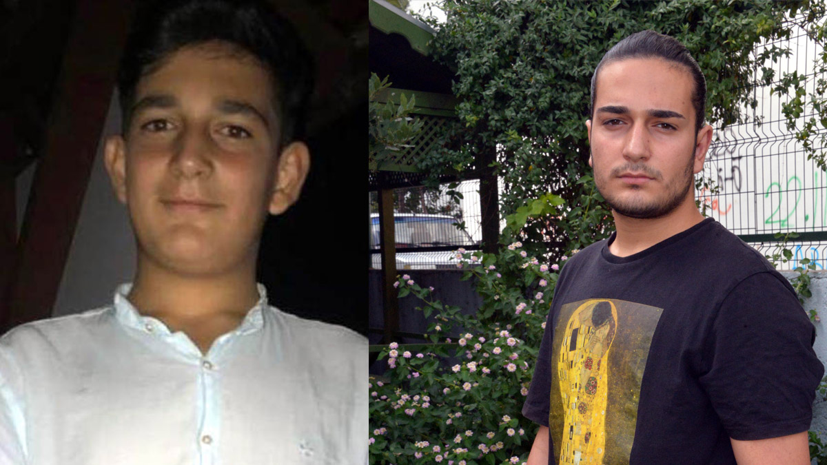 Hayali olan oyunculuk için 12 ameliyat geçirdi