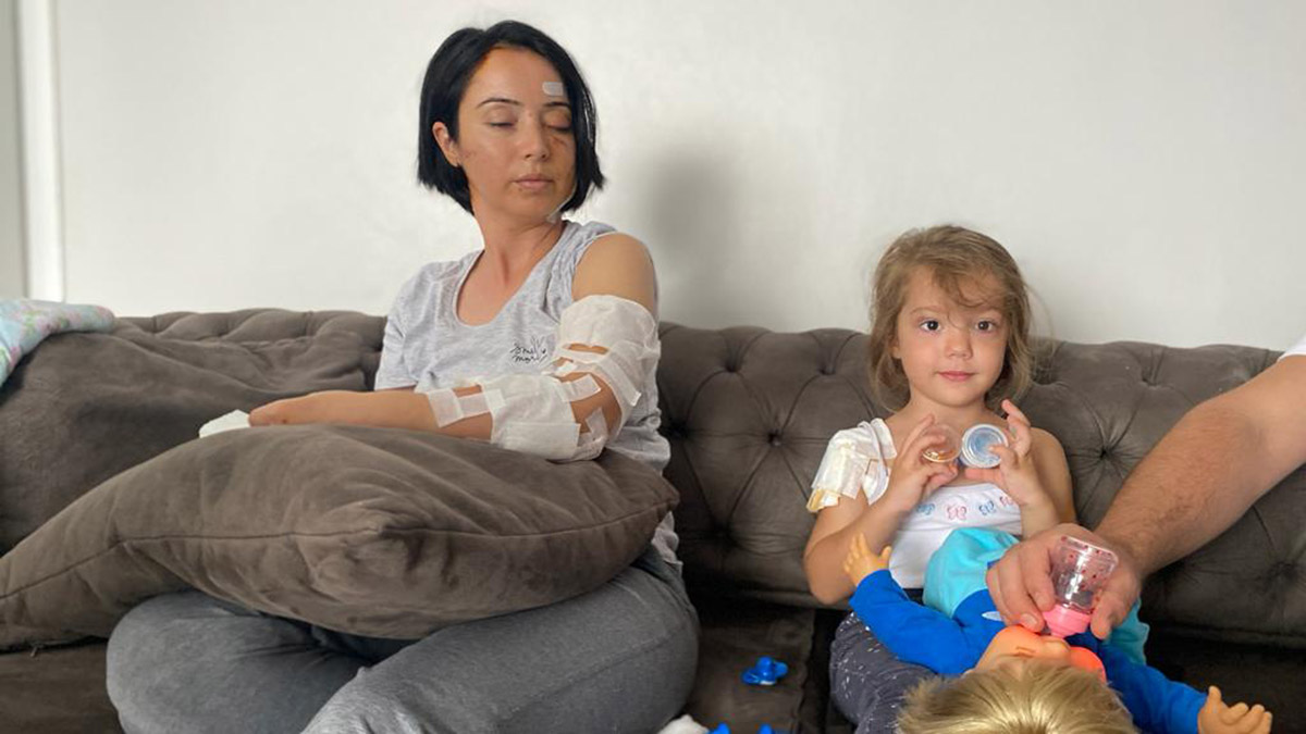 Köpek saldırısına uğrayan anne ile kızı yaralandı