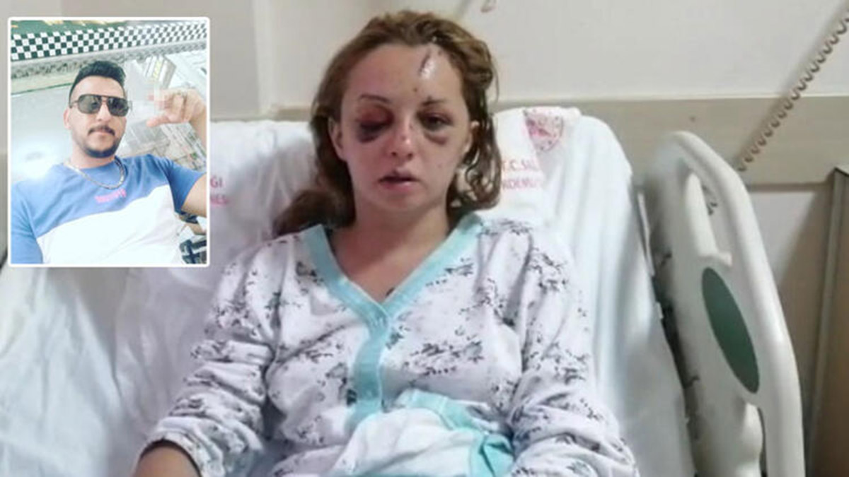 Öldüresiye dövülen Rahime: Kafama taşla vurdu