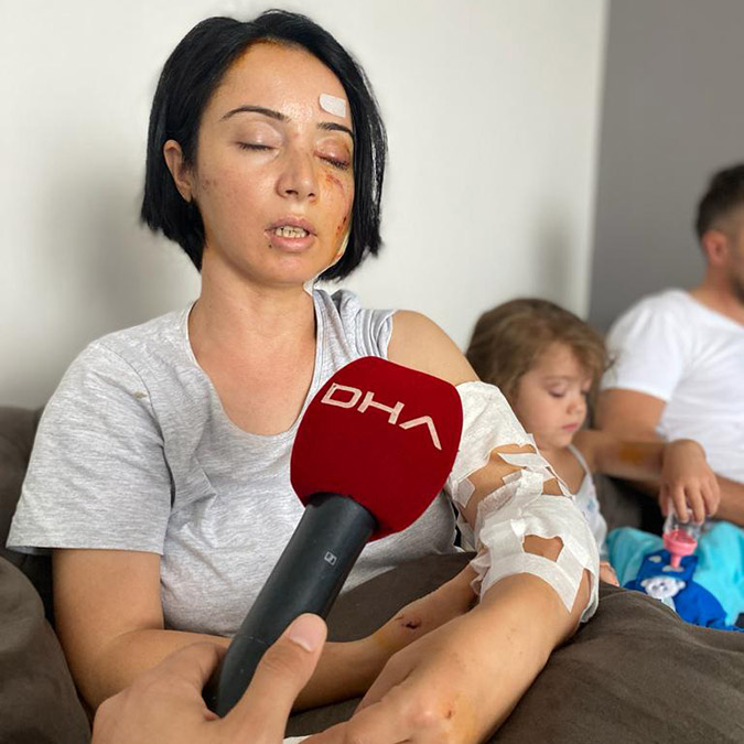 Samsun'da anne-kıza saldıran yasaklı ırk köpeklerden biri gözlem altında, diğeri aranıyor.