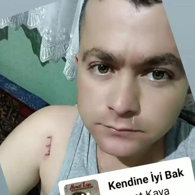 Emine hemşire böbreğini kaybetti