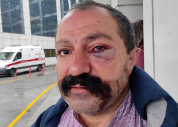 Ev sahibinin kardeşinin yumruklu saldırısına uğradı