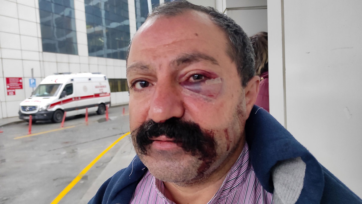 Ev sahibinin kardeşinin yumruklu saldırısına uğradı