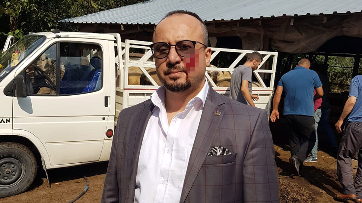 Avukatın yanağını ısırdı; 4 yıl ceza aldı