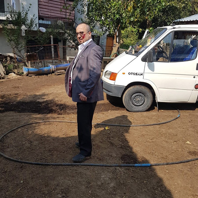 Bursa’da, müvekkiline olan borcuna karşılık koyunlarını hacze gelen avukatın yanağını ısırdı ‘Kasten adam yaralamak’ suçundan 4 yıl 2 ay hapis cezası aldı.