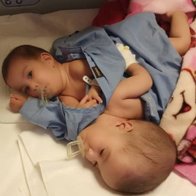 Siyam ikizleri Safaa ve Shiffa taburcu oldu