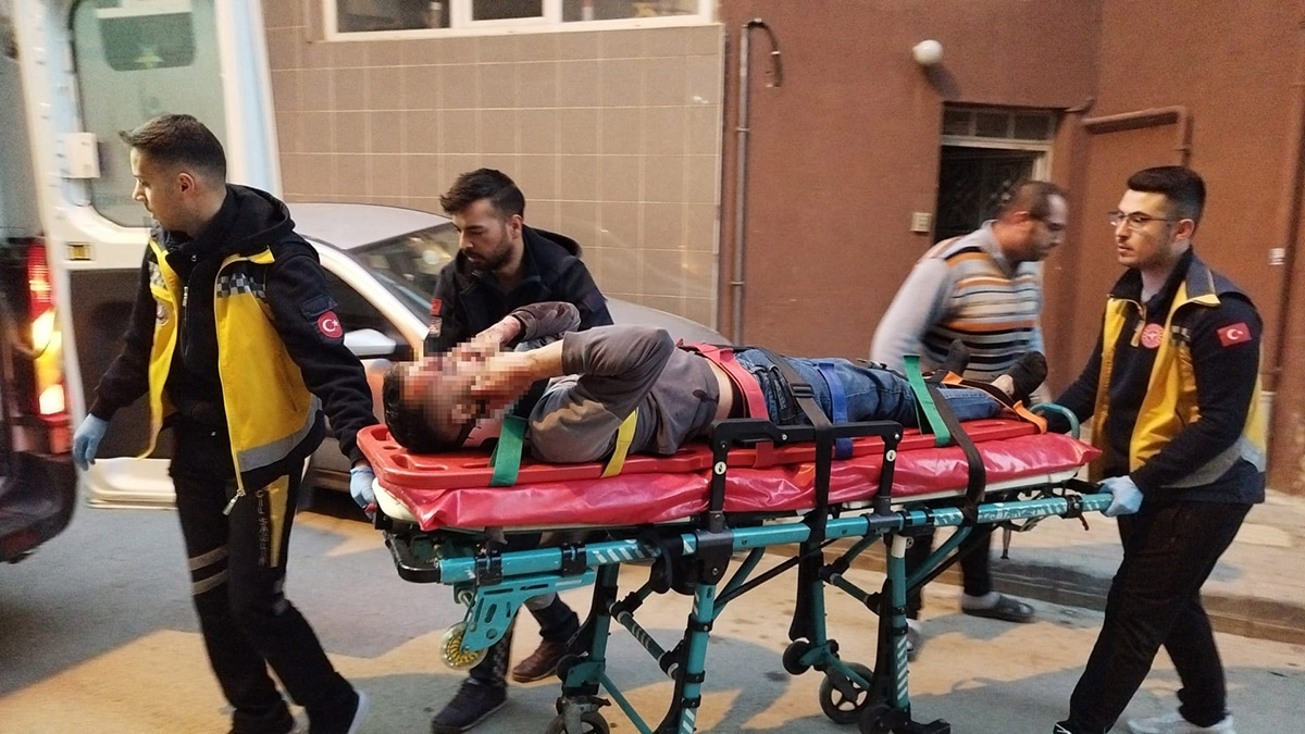 Sokak ortasında kanlar içinde bulundu