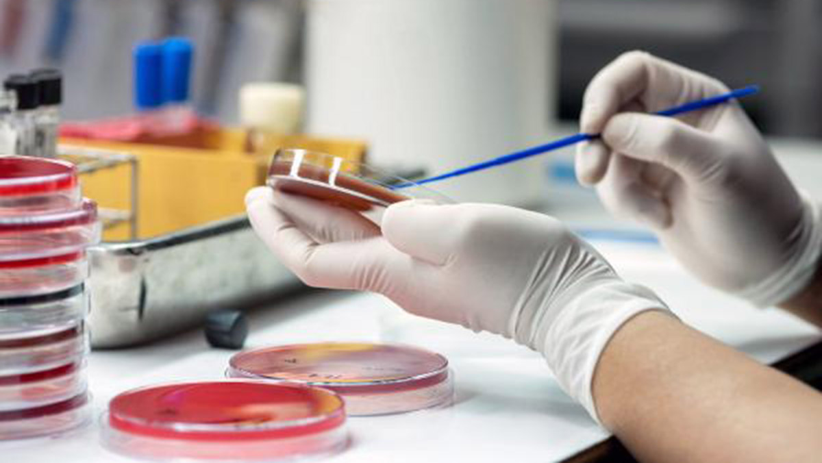 Bitkilerde su stresine karşı önleme çalışmaları