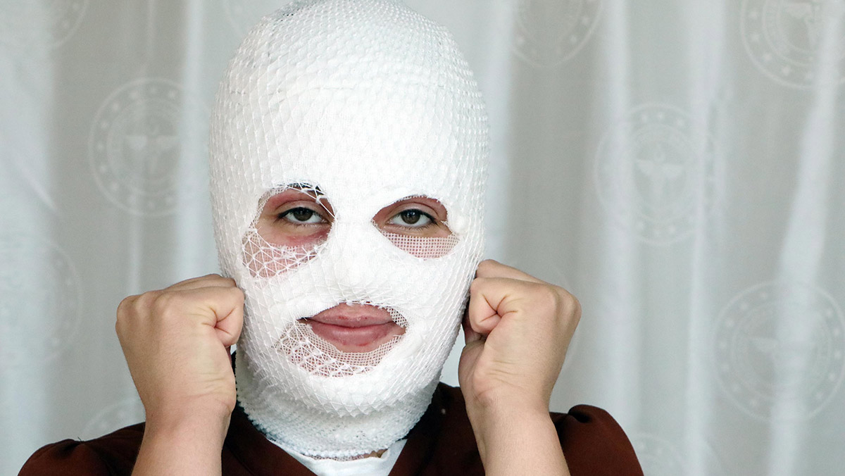 Düdüklü tencerenin patlamasıyla hastanelik oldu