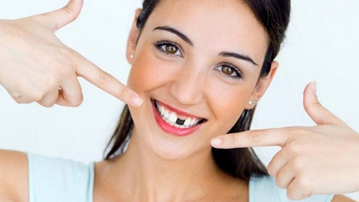 Eksik dişlerin zararına dikkat