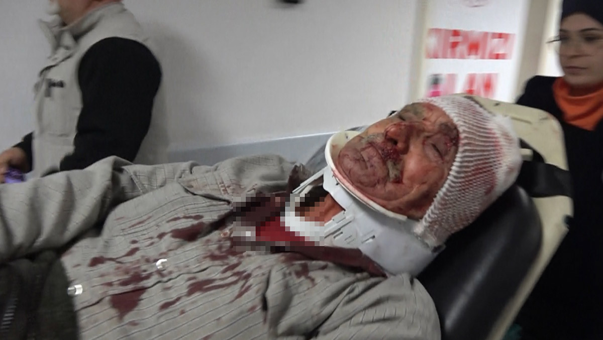 Ev sahibi kiracı kavgasında kolundan vuruldu