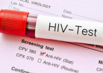 Hamilelere HIV taraması uyarısı
