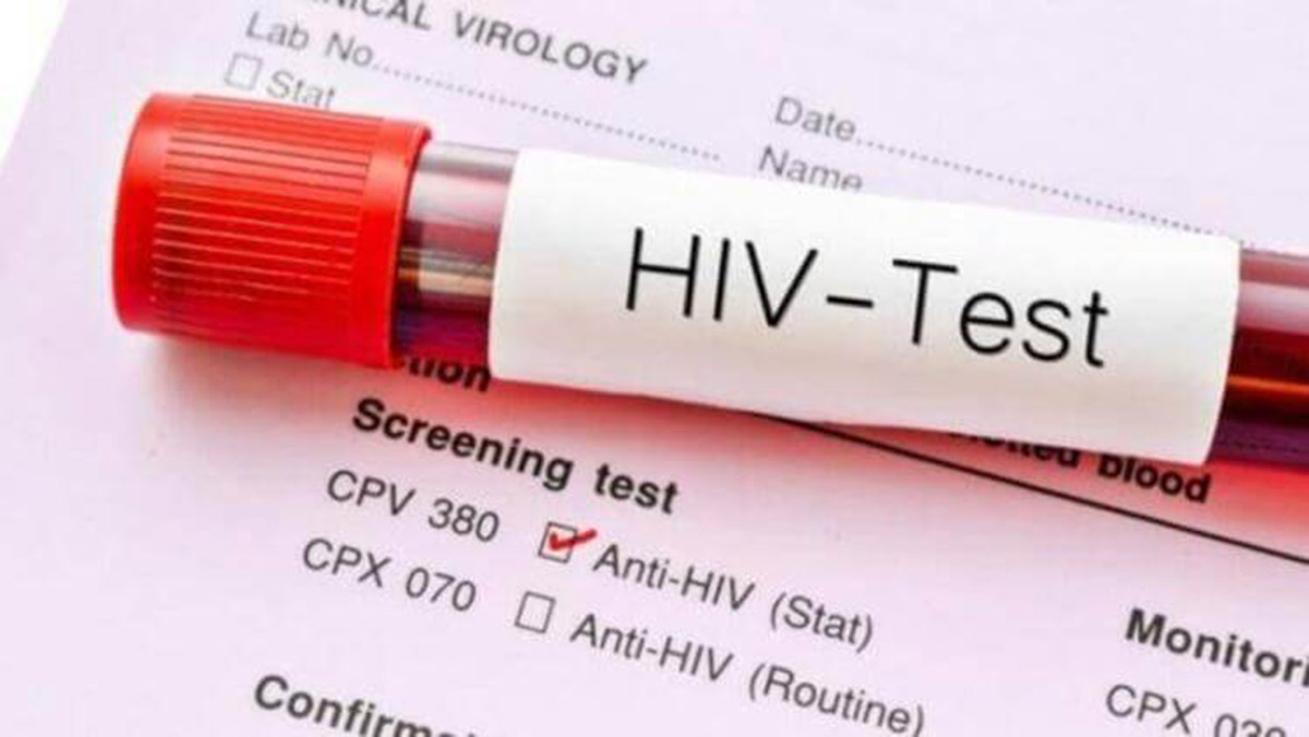 Hamilelere HIV taraması uyarısı