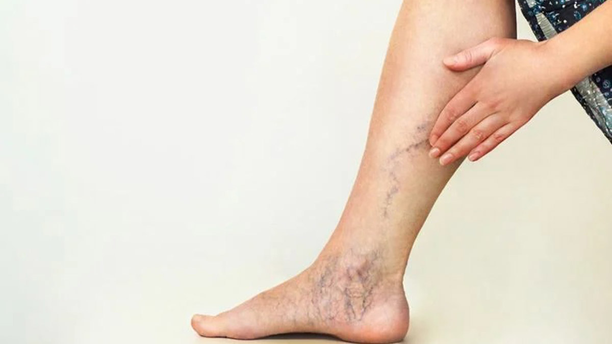 Hareketsiz yaşam varis sebebi