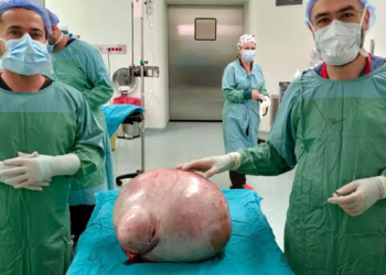 Karnından 35 kilo ağırlığında kitle çıkarıldı