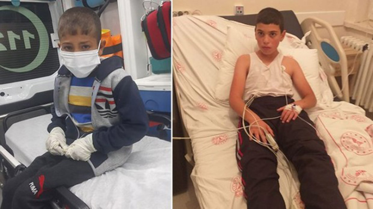 Köpek ısıran 2 çocuktan birine kuduz teşhisi