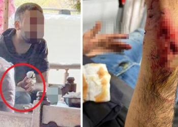Önce Pitbull sonra sokak köpeği saldırdı; kuduz aşısı yapıldı