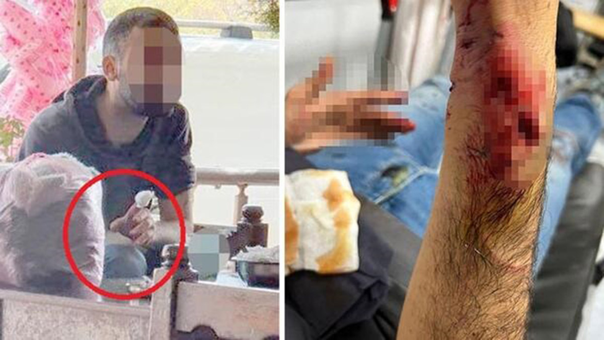 Önce Pitbull sonra sokak köpeği saldırdı; kuduz aşısı yapıldı