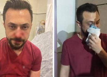 Şanlıurfa'da saldırıya uğrayan doktorun burnu kırıldı