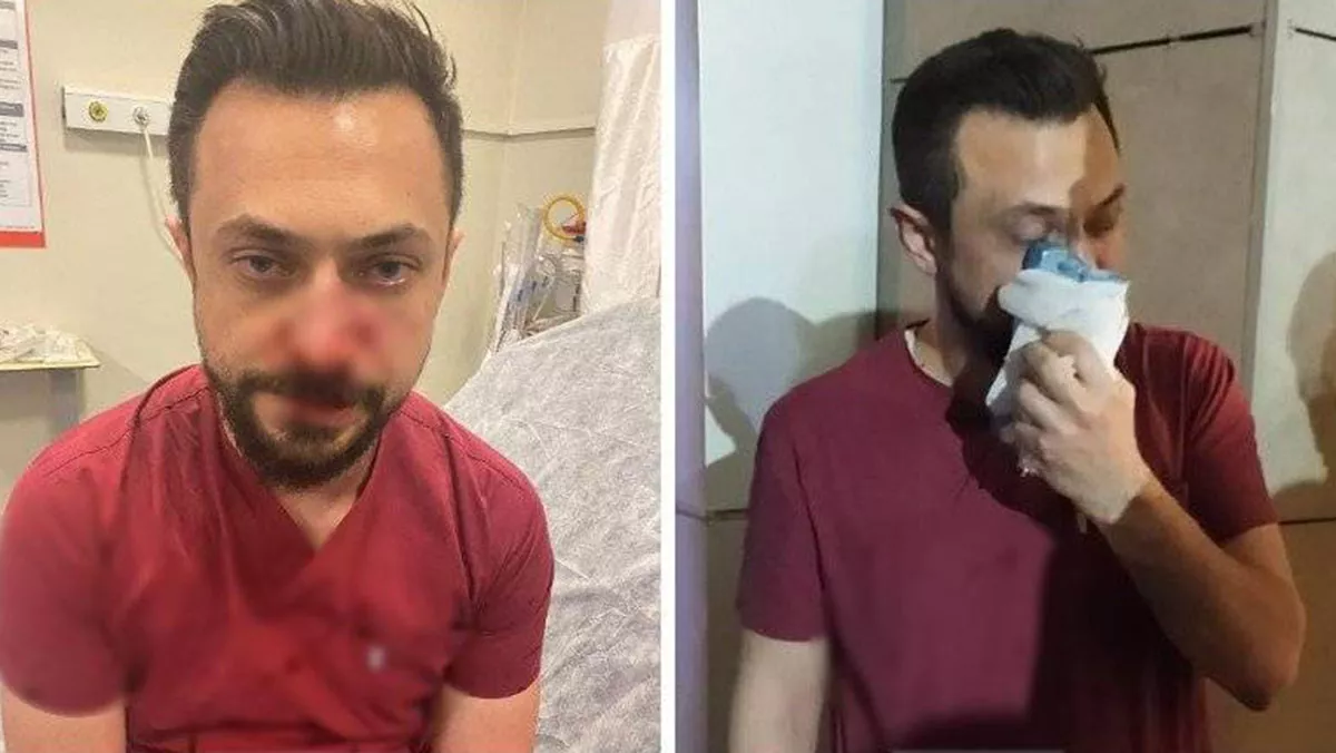 Şanlıurfa'da saldırıya uğrayan doktorun burnu kırıldı