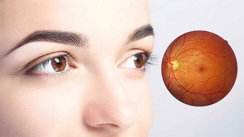 Sarı nokta hastalığına ışık cihazlı çözüm