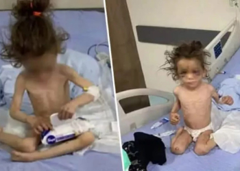 Şiddet mağduru Fridevs tedavisini takip ediyoruz