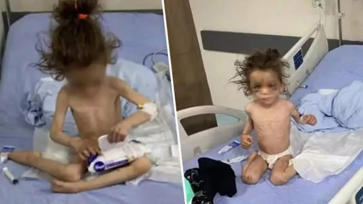 Şiddet mağduru Fridevs tedavisini takip ediyoruz