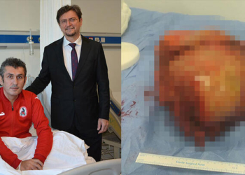 Vücudundan 6 kiloluk kitle çıkarıldı