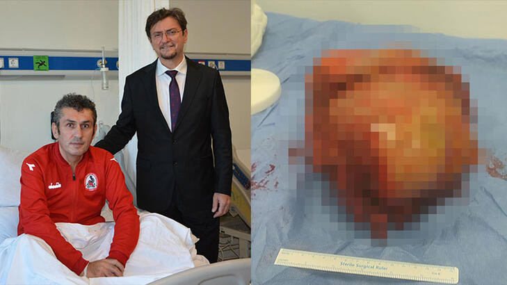 Vücudundan 6 kiloluk kitle çıkarıldı