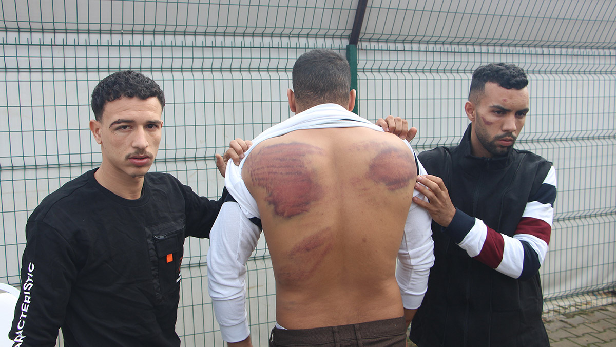 Yunanistan'ın darbettiği göçmen: İşkence ettiler