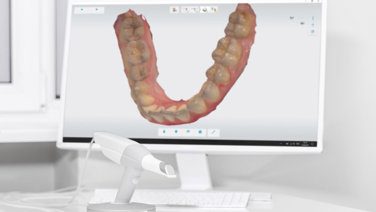 Diş tedavilerinde uzun vakit harcanan ölçü alma işlemleri artık geride kalıyor. Geliştirilen 3D tarayıcı teknolojisi, diş ölçüsü alma işlemlerinin kısa sürelerde gerçekleştirilmesini sağlarken, tedaviyi hem hastalar hem de hekimler için konforlu kılıyor.