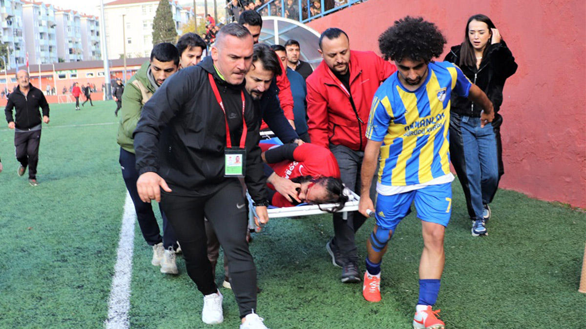 Kaleci futbolcuyla çarpıştı, kafa kemikleri kırıldı