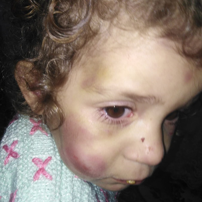 Küçük Firdevs'e şiddet uygulayan anne tutuklandı