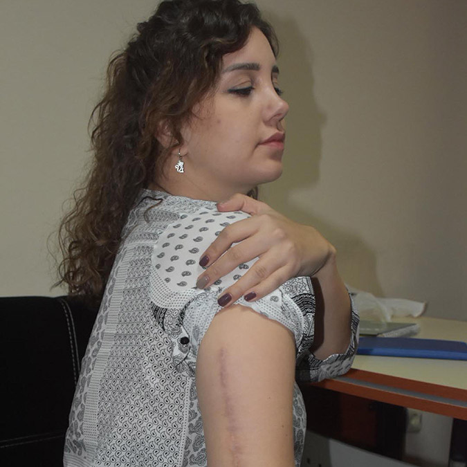 Kız arkadaşının kolunu kıran sanığa iyi hal indirimi