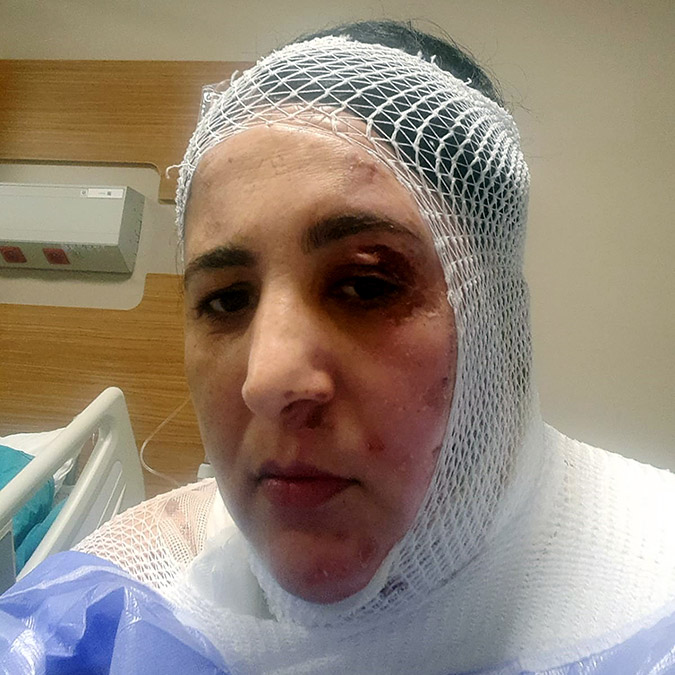 Üvey annesine kezzapla saldıran kişi tutuklandı