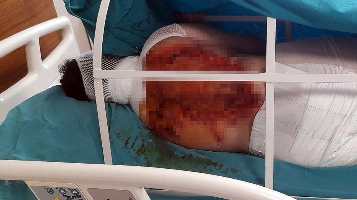 Üvey annesine kezzapla saldıran kişi tutuklandı