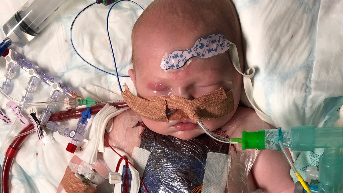 Bebeğin kalbi kök hücre enjeksiyonuyla iyileştirildi