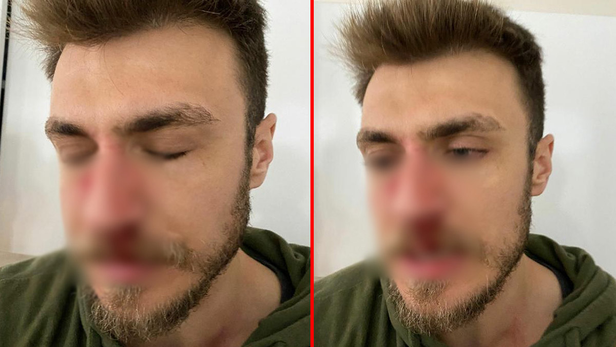 Eşi için kadın doktor istedi, erkek hekime saldırdı